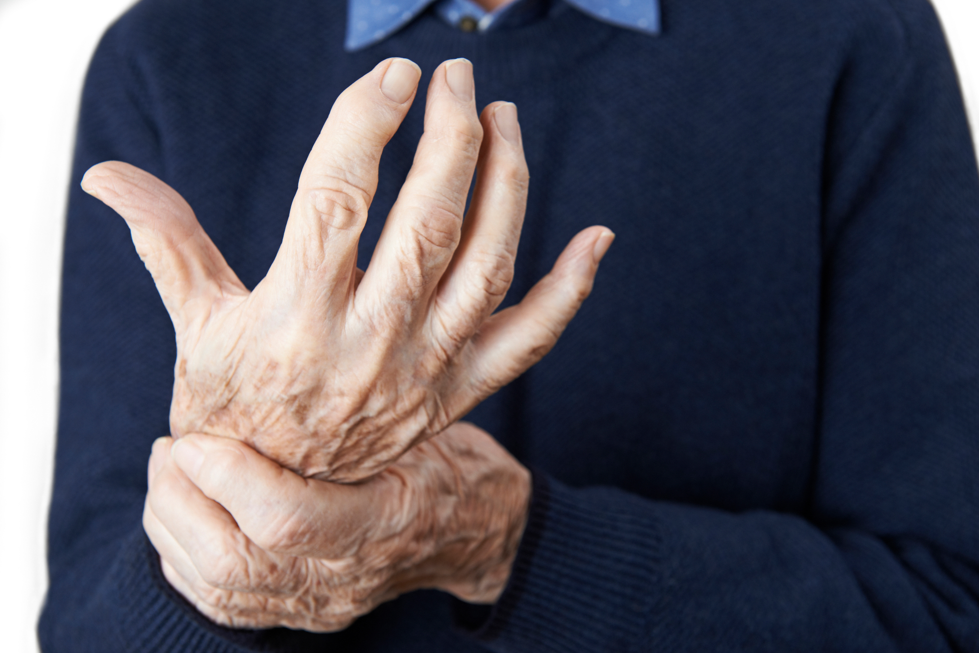 Revmatoidni artritis je nekaj kar ljudje znajo zelo dobro skrivati